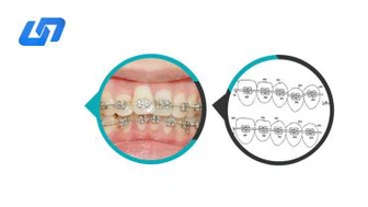 Orthodontische Niti Color Arch Wire